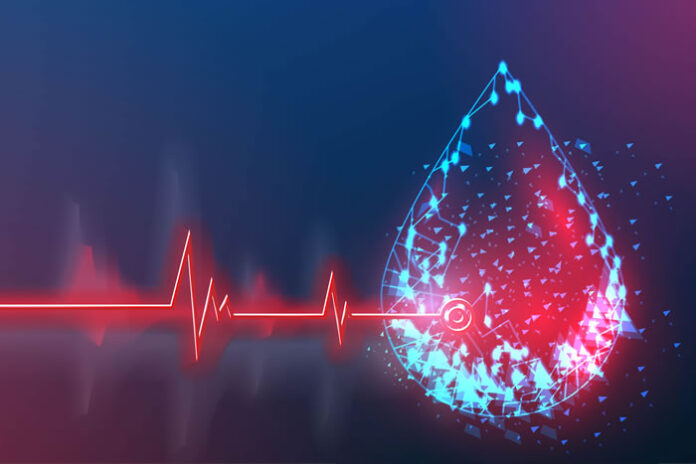 digital representation of a heartbeat on EKG