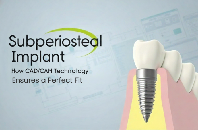 Subperiosteal Implant