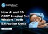 How AI and 3D CBCT Imaging Cut Wisdom Tooth Extraction Costs headline for how ai and 3d cbct imaging reduce wisdom tooth extraction costs