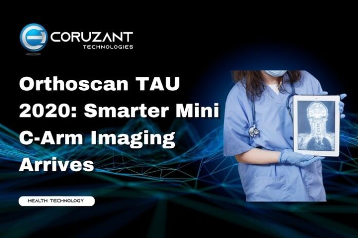 Chatbot Testing - Coruzant Technologies - 2026-09-04T003344.451 headline for orthoscan tau 2020: smarter mini c arm imaging